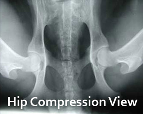 compression view