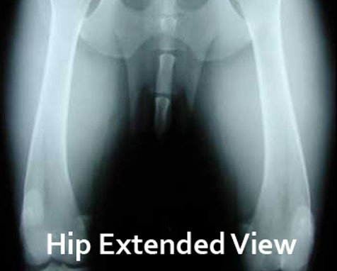 hip extended view2